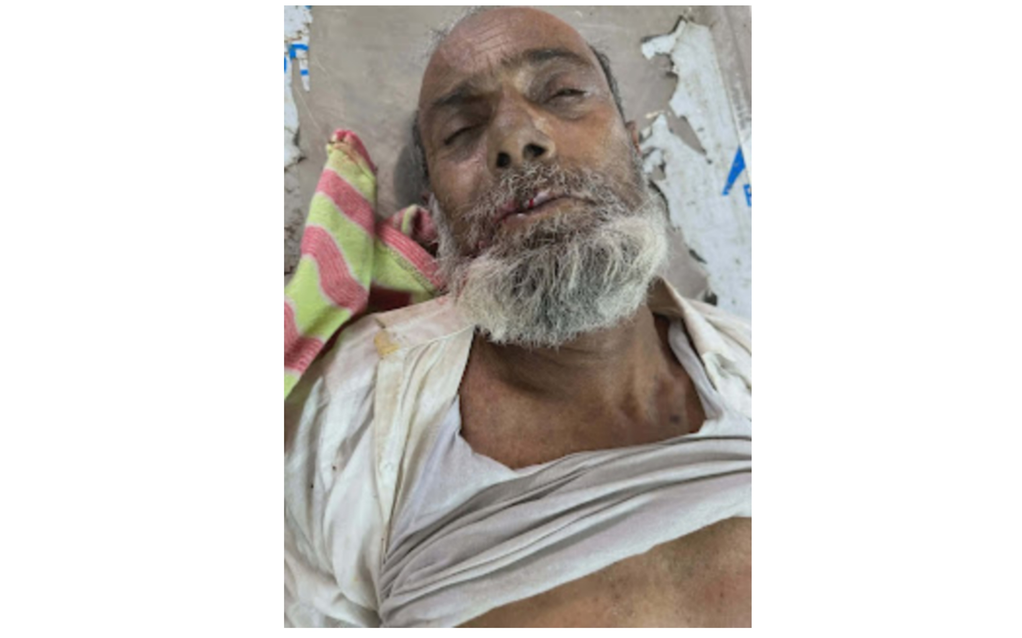 মিঠামইনে বিএনপি-আওয়ামীলীগ সংঘর্ষে আহত কৃষক রহম আলীর মৃত্যু