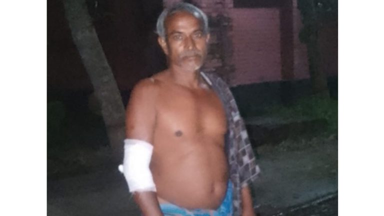দিঘলিয়ায় মাছ ব্যবসায়ীকে হাতুড়ি দিয়ে পিটিয়ে আহত, ৫০ হাজার টাকা ছিনতাইয়ের অভিযোগ