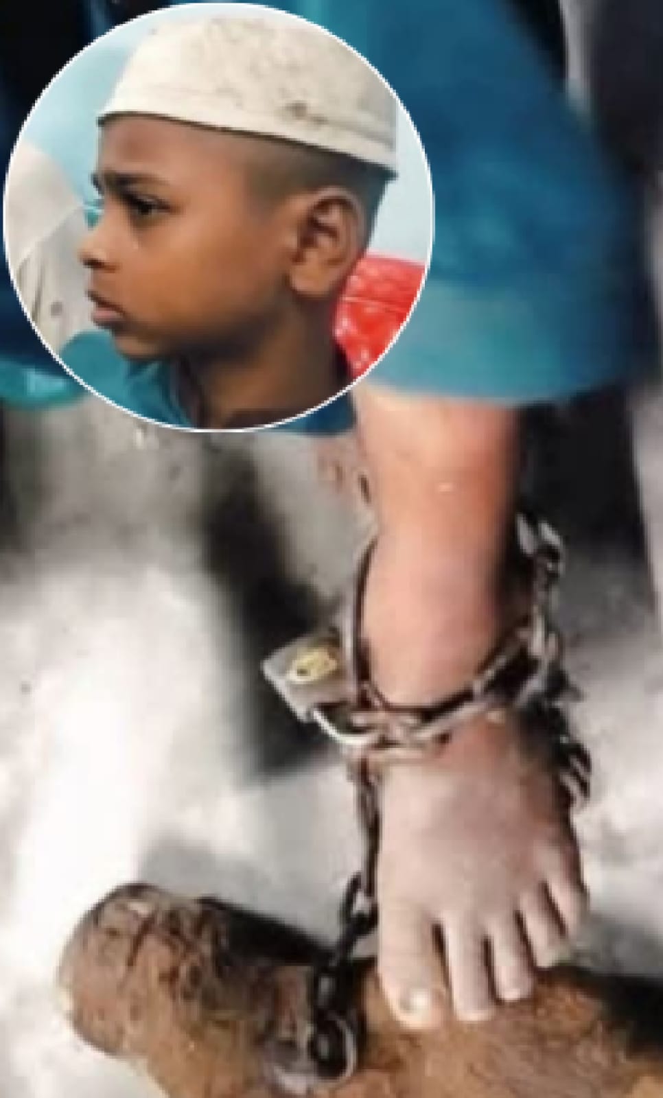 খুলনা নগরীর আরংঘাটার মাদ্রাসায় ১০ বছরের শিশুর পায়ে শিকল বেঁধে নির্যাতনের অভিযোগ